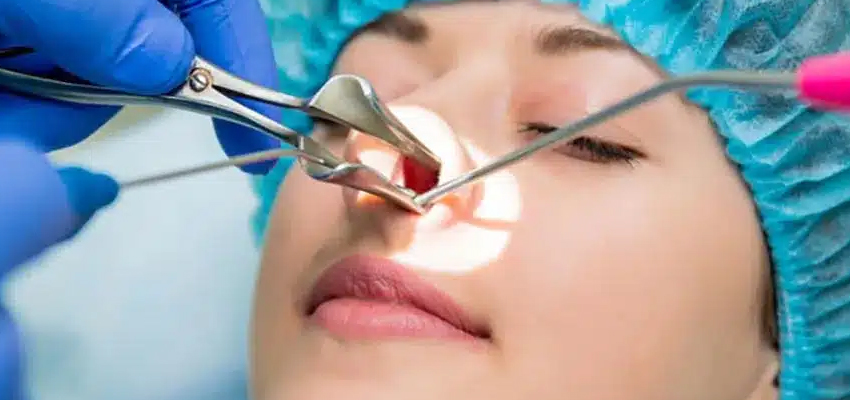 Endoscopic DCR