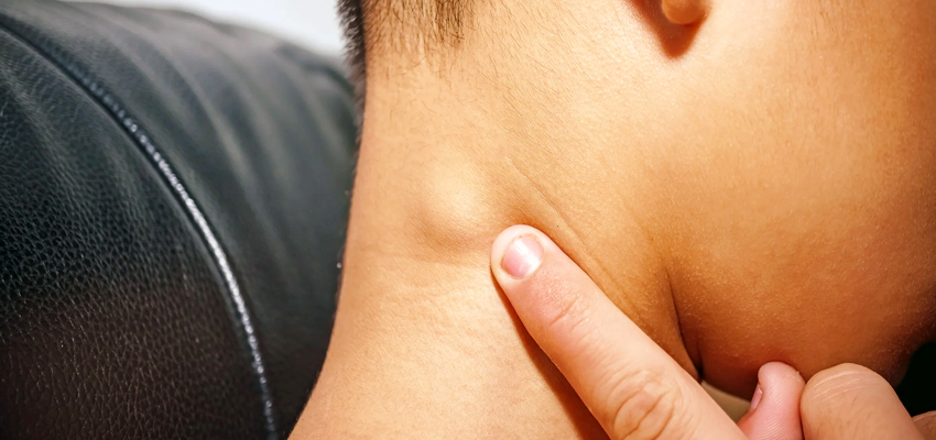 Neck Mass Evaluation