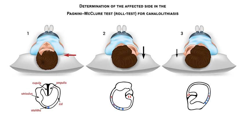 Supine Roll / McClure Pagnini Test
