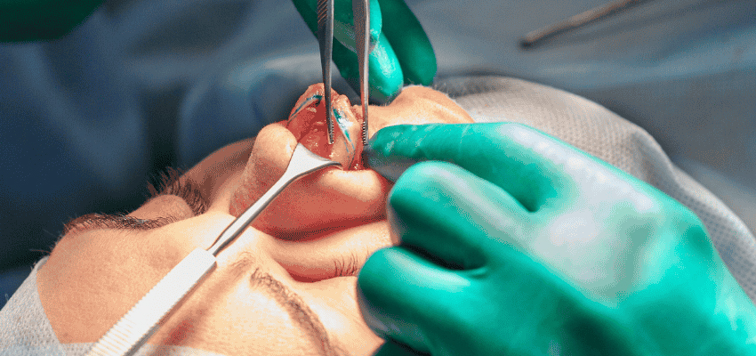 Turbinoplasty